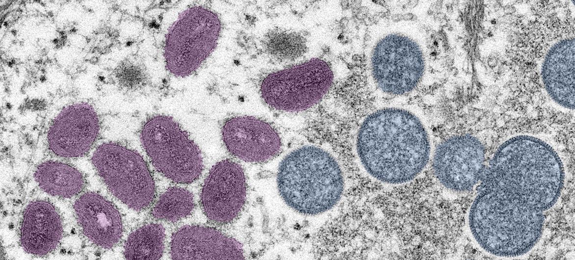 Monkeypox is a rare but dangerous infection similar to the now eradicated smallpox virus. Monkeypox is a rare but dangerous infection similar to the now eradicated smallpox virus.