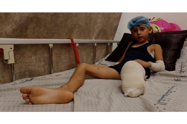 Driven by hunger in Gaza, amputees are part of the collateral damage | UN News
