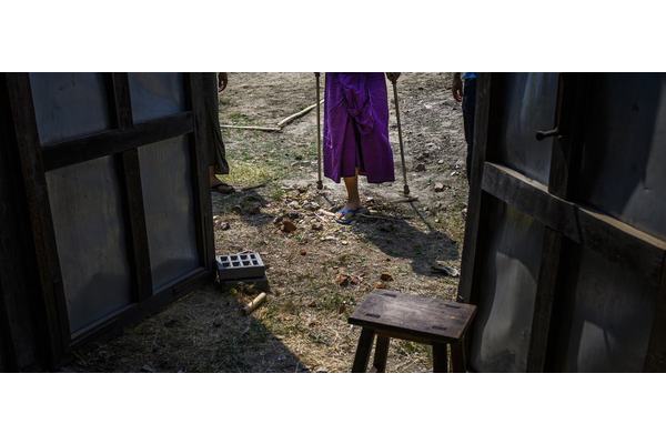 Children and amputees bear brunt of Myanmar’s deadly landmine epidemic | UN News