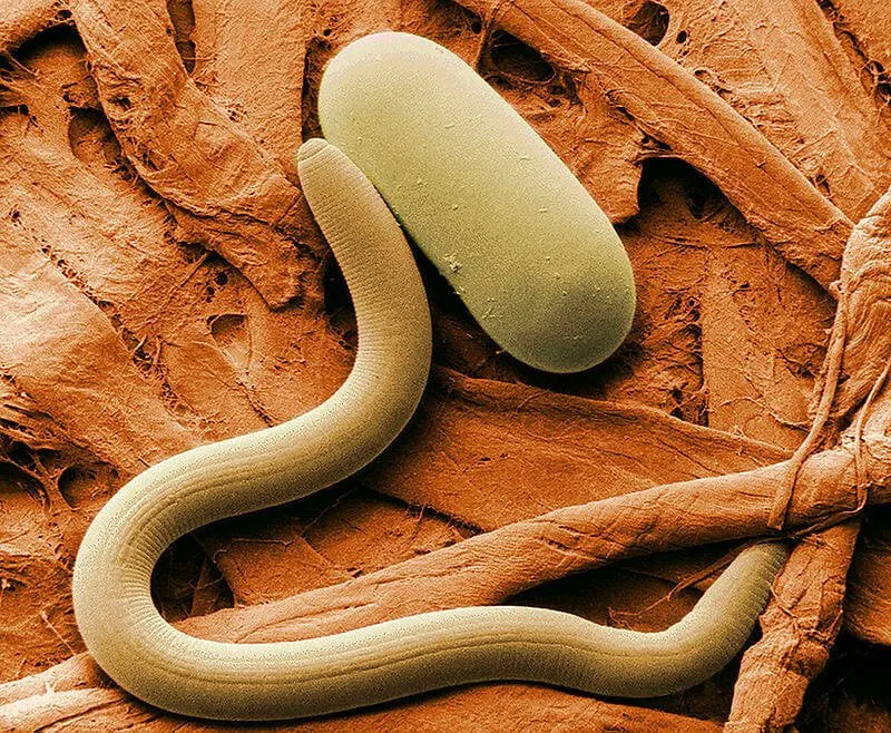px soybean cyst nematode and egg sem