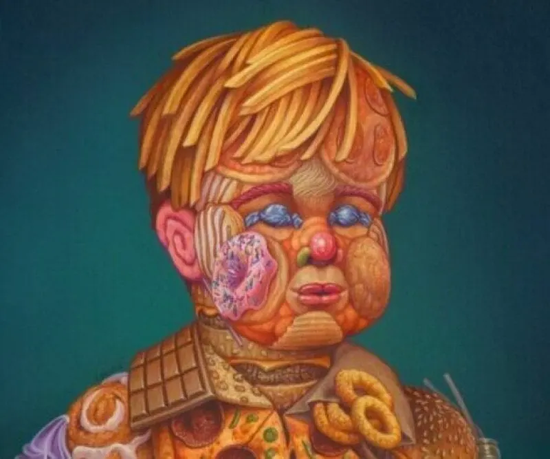 "Childhood Obesity" Credit: Joseph Salina