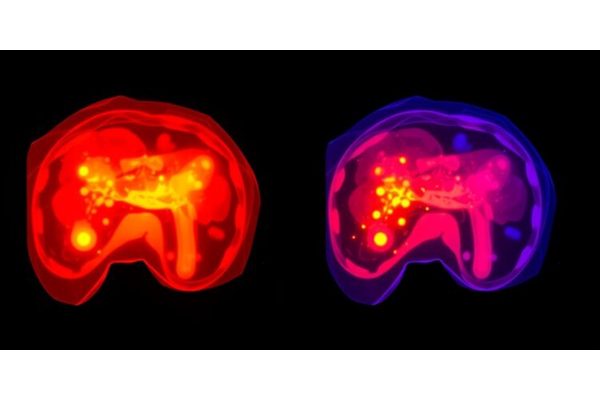 Advancing Fluorescence-Guided Surgery for Hepatocellular Carcinoma: Bridging Clinical Practice and Laboratory Research