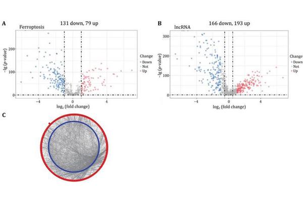 New Prognostic Model for Acute Myeloid Leukemia Leverages Ferroptosis-Related lncRNA and Immune Infiltration Insights