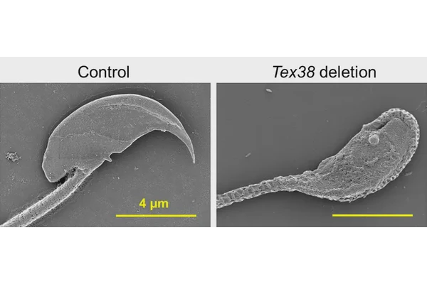 Revealing the Essential Protein Complex for Male Fertility