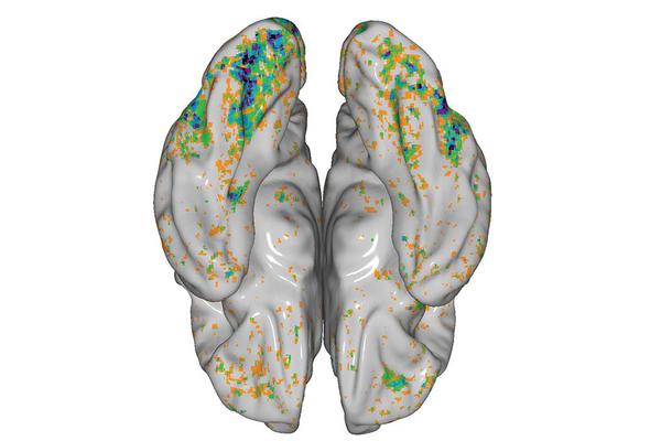 Carnegie Mellon University Researchers Develop Framework to Uncover Brain Mechanisms Behind Food Selectivity