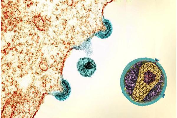Promising New Therapy Shows Potential for Effective HIV Control in Uganda
