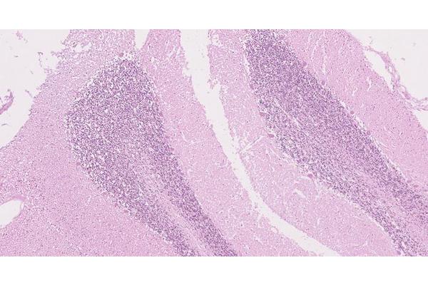 New Research Sheds Light on the Complexities of Cancer Predisposition