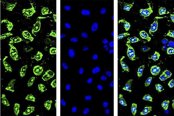 Revolutionary Drug Screening Technique Promises Solutions to Delivery and Efficacy Challenges