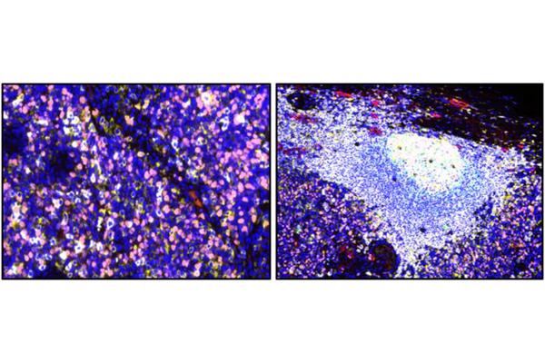Breakthrough Discovery: Researchers Uncover Dysfunctional B Cells as a Novel Target for Cancer Immunotherapy