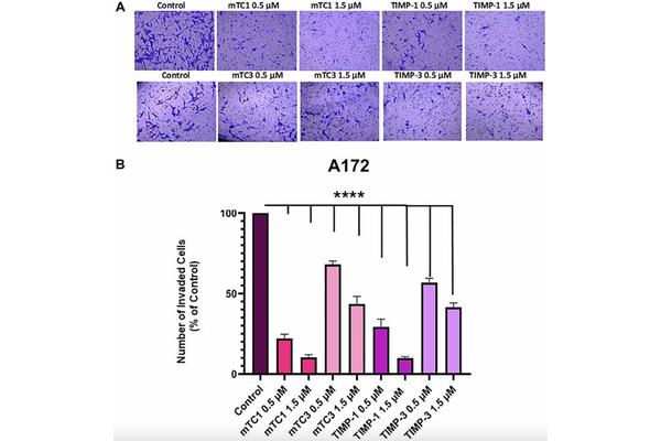 Engineered TIMP Molecules Demonstrate Promise in Impeding the Spread of Glioblastoma