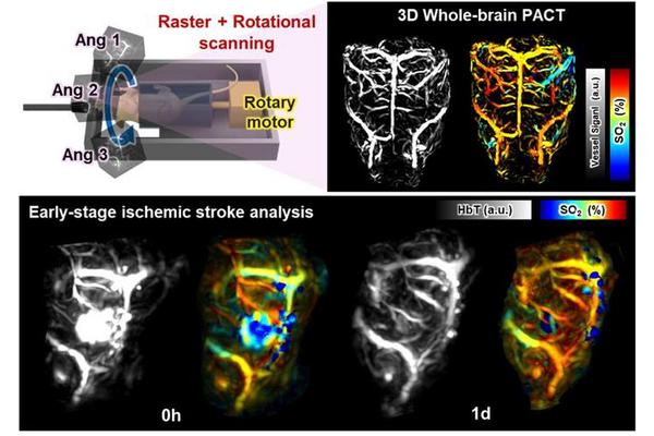 Advancements in Stroke Detection: Harnessing Light and Sound for Real-Time Monitoring