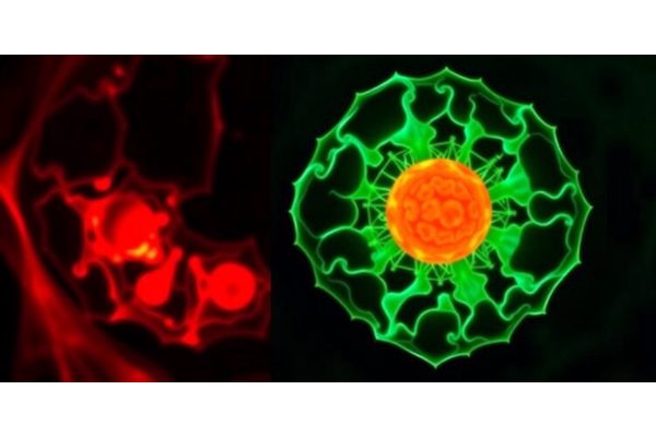 Peritoneal Adipose Stem Cell-Derived Extracellular Vesicles Enhance Ovarian Cancer Progression through EGFR-NF-κB Pathway Activation