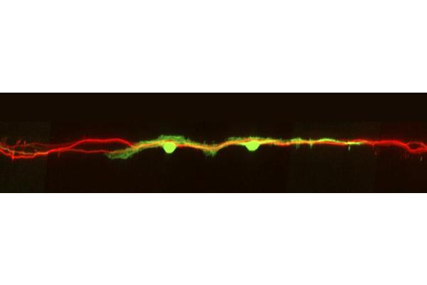 HDAC8 Inhibition Boosts Neuronal Regeneration and Enhances Sensory Function Recovery