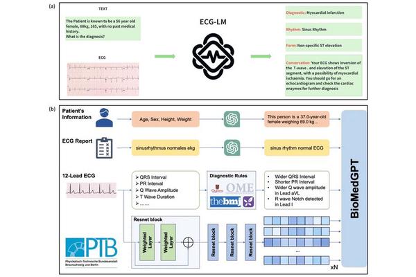 Revolutionizing Cardiovascular Care: Innovative ECG Data Analysis Using Advanced Language Models