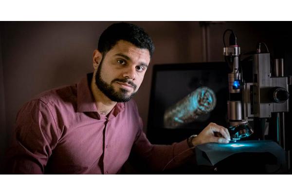 Emboa Medical Develops and Validates Innovative Catheter to Enhance Outcomes for Stroke Patients
