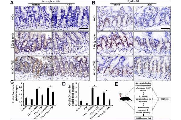 Senolytic ABT-263 Shows Promise in Mitigating Radiation-Induced Gastrointestinal Cancer
