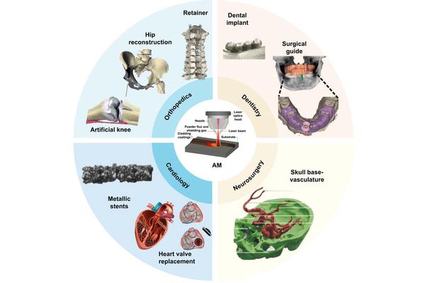 Advancements in Additive Manufacturing for Biomedical Metals in the Creation of Medical Implants