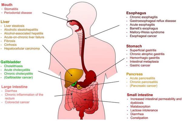 Impact of Ethanol Consumption on Digestive Health: A Scientific Overview
