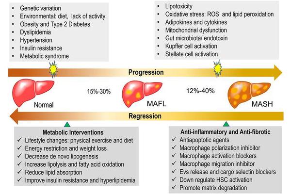 Exploring Innovative Approaches to Treat Metabolic Dysfunction-Associated Fatty Liver Disease