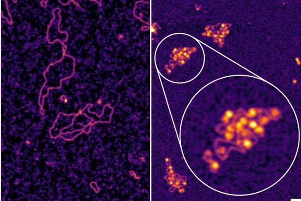 Exploring a Decade-Old Hepatitis B Enigma Unveils Promising New Treatment Possibilities
