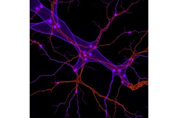 Functional Synapses Link Neurons and Lung Cancer