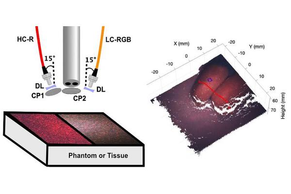 Revolutionary Laparoscopic Imaging Technique Enhances Precision in Mapping Biological Tissue for Minimally Invasive Surgery