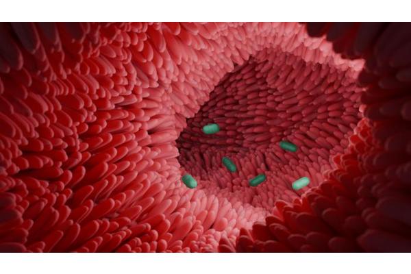 Intestinal Microbiota: A Key Player in Colon Health