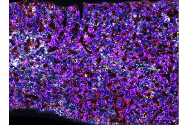 Positive Genetic Adaptations Detected in Regular Blood Donors