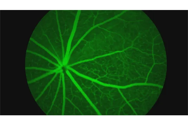 Breakthrough Study Reveals Genetic Links to Retinal Aging and Brain Health