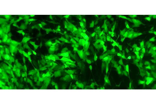 Revolutionary Enzyme Engineering Paves the Way for Innovative Treatments in Parkinson’s Disease, Cancer, and Challenging Protein Disorders