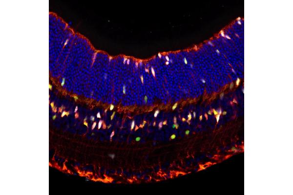 USC Stem Cell Researchers Discover Common Genes Linked to Regeneration in Hearing and Vision