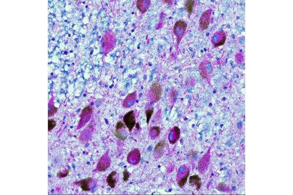 Exploring the Link Between Cholesterol Regulation and Alzheimer’s Disease Development