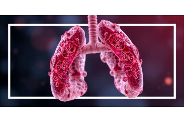Strategic Approaches to Combat Fibrosis: The Latest Findings