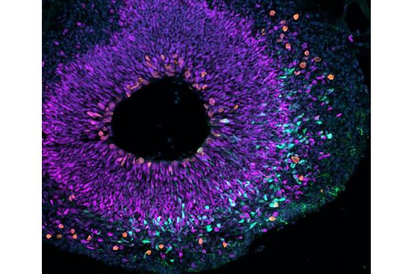 Unraveling the Evolution of the Large Brain: How Did It Happen?