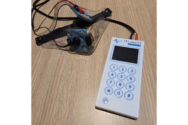 Brain Stimulation Offers Hope in Alleviating Fatigue for Post-Stroke Patients
