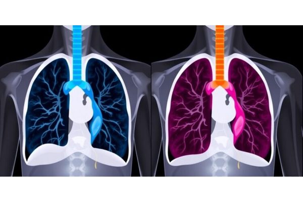 Optimal Lymph Node Examination and Ratio Guidelines for Postoperative Adjuvant Radiotherapy in pN2 Non-Small Cell Lung Cancer: Insights from a Multicenter Retrospective Study