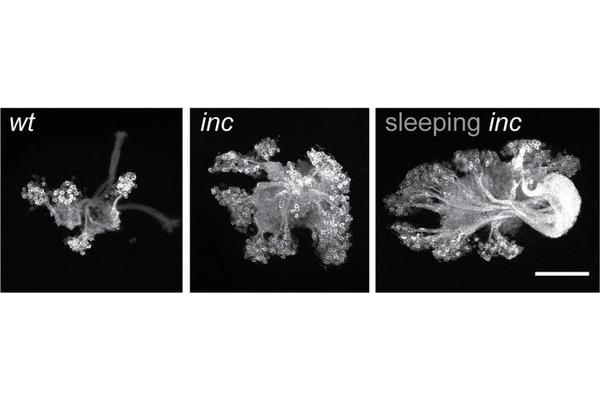 Insomniac Fruit Fly Mutants Exhibit Improved Memory Abilities Despite Significant Sleep Deprivation