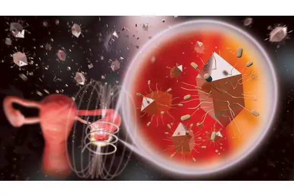 Revolutionary Nanoparticles with Distinct Designs Accelerate Heating to Inhibit Ovarian Tumor Progression