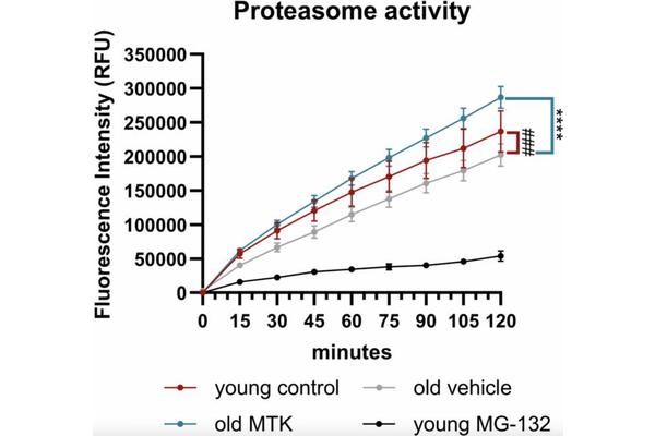 Montelukast Enhances Retinal Health in Aging Murine Models