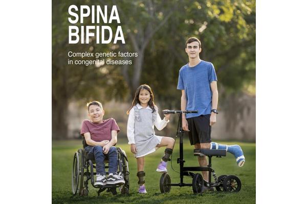 New Study Illuminates Causes of Spina Bifida and Explores Potential Treatments