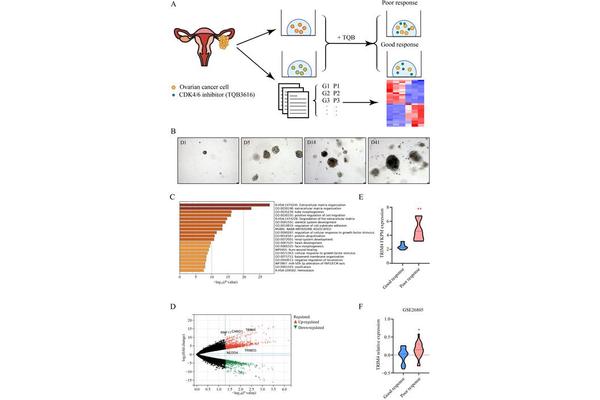 TRIM4 Influences hnRNPDL Degradation via Ubiquitin Pathway, Impacting Sensitivity to CDK4/6 Inhibitors in Ovarian Cancer