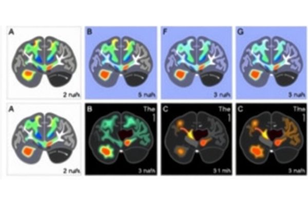 Mapping Brain Mitochondria: Energy Boost in Regions Linked to Advanced Cognition