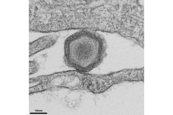 Scientists Innovate New Tools to Enhance Vaccine Development for African Swine Fever Virus (ASFV)