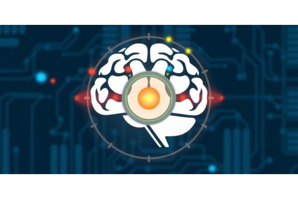 Breakthrough Diagnostic Tool for Anxiety and Major Depression Developed by NCSA Research