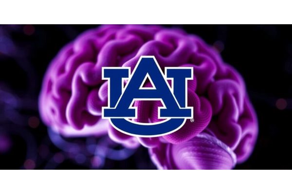 Auburn University Researchers Unveil Critical Insights into Brain Function and Alzheimer’s Disease