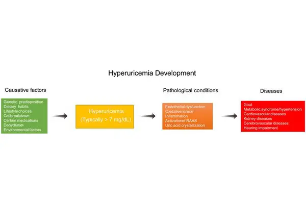 Hyperuricemia: Latest Insights and Future Directions in Research