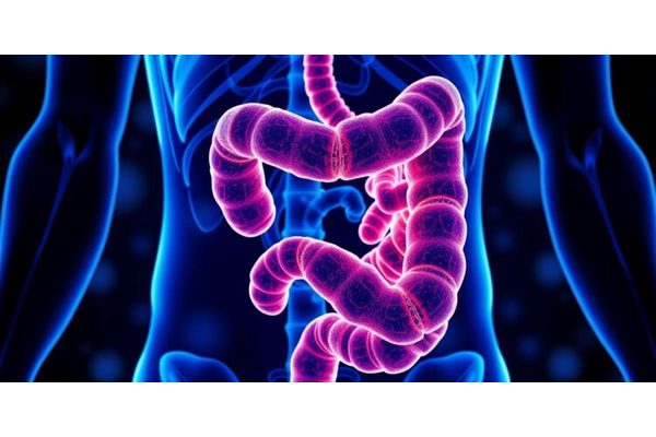 Breakthrough Analysis Reveals Expanded Immunotherapy Options for Colorectal Cancer