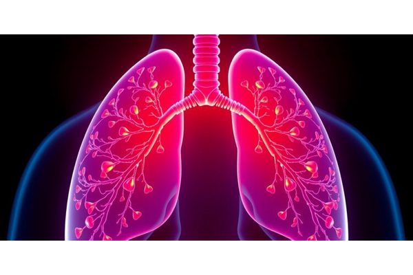 Induction Chemotherapy Combined with Camrelizumab and Apatinib Shows Promise as a First-Line Treatment for Extensive-Stage Small-Cell Lung Cancer in Multicenter Trial