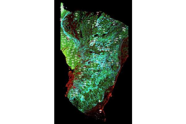 Singaporean Researchers Create Tumor Maps to Enhance Precision Treatment for Stomach Cancer