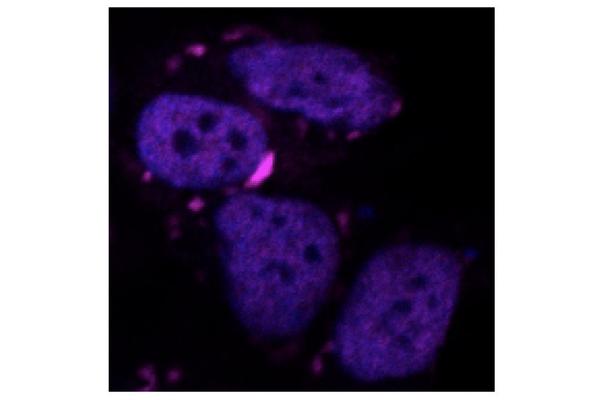 AI-Powered Algorithm Targets Proteins Linked to Brain Damage